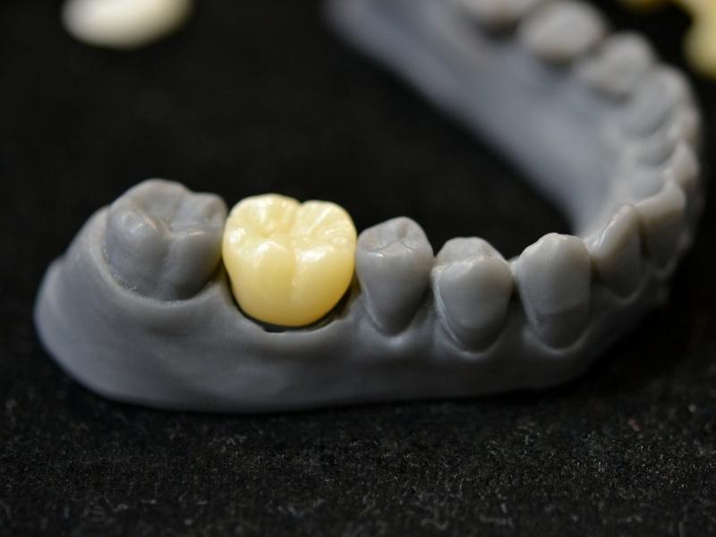 A IMPRESSÃO 3D E A SUA APLICAÇÃO NA ODONTOLOGIA.